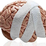 Brain