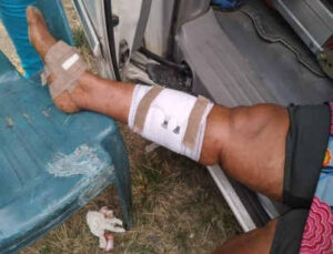 BREAKING: Multiple Explosion Rocks Port Harcourt APC Rally, Three Injured (Photo)