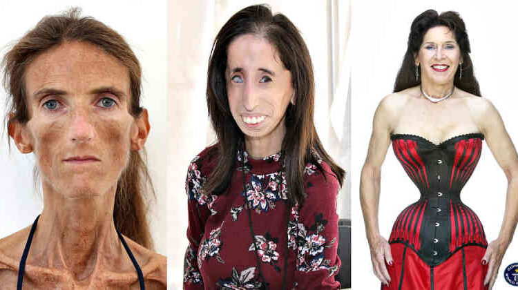 Skinniest People in the world