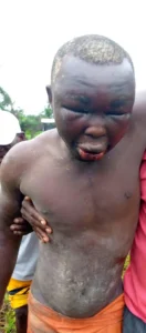 Man found alive in Bayelsa forest with hands and legs tied after being attacked by unknown assailants (photos)