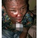 Nigerian Pastor Beaten Beyond Recognition Over Disappearance of Male Organ