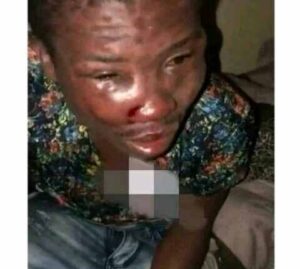 Nigerian Pastor Beaten Beyond Recognition Over Disappearance of Male Organ