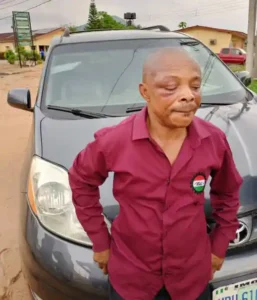 NLC President Joe Ajaero’s Eyes in Jeopardy After Arrest in Imo State