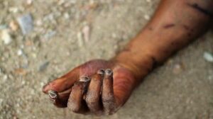 Dismembered Dead Body Of Young Man Found In Refuse Dumpsite In Benue