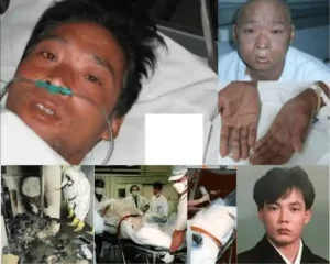 Do you know Hisashi Ouchi? Victim of a Harrowing, Unusual Death