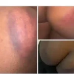 EFCC Brutalises Females