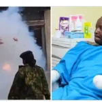 Kenyan Police Officer Loses Both Forearms Attempting to Throw Teargas Canister at Peaceful Protesters