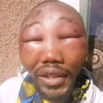 APC Ward Chairman Beaten Beyond Recognition in Kebbi State While Preaching Tinubu's Achievements.