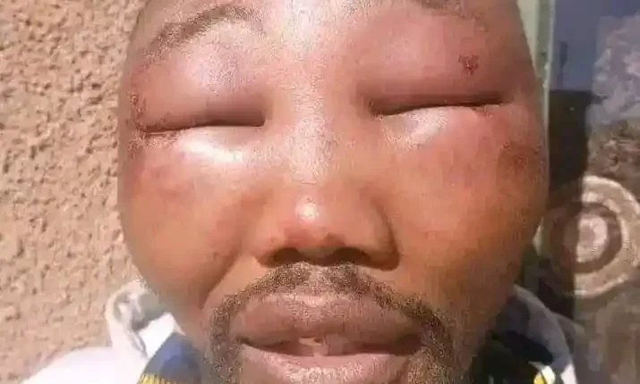 APC Ward Chairman Beaten Beyond Recognition in Kebbi State While Preaching Tinubu's Achievements.