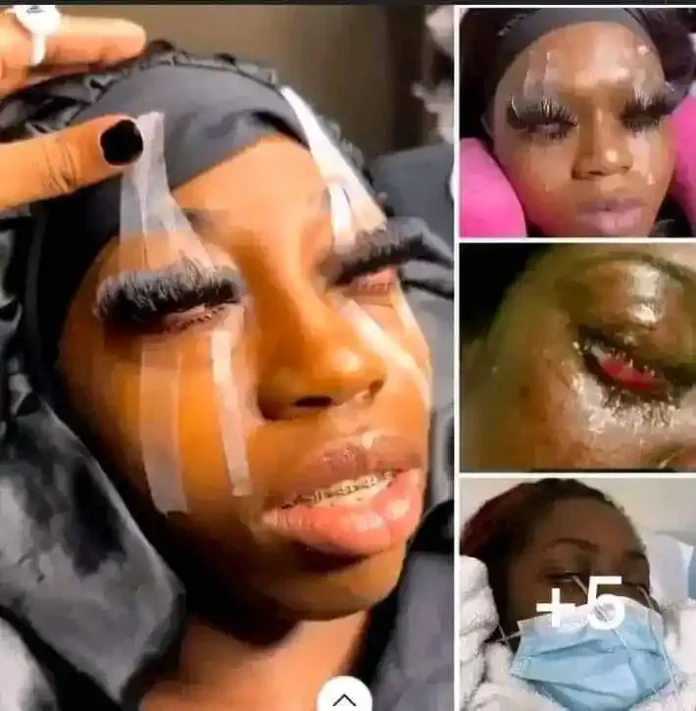 Nigerian Lady Goes Blind After Fixing Expensive Eyelashes Worth ₦30,000