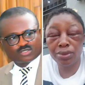 No Mercy for Wife Beaters: Police Detain Cross River Lawmaker Over Assault of Spouse