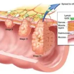 Stop Cancer Before It Starts: 10 Must-Know Tips
