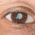 How to Keep Your Eyes Healthy
