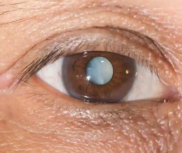 How to Keep Your Eyes Healthy: Science-Backed Care Tips