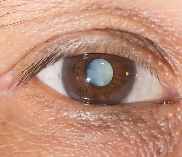 How to Keep Your Eyes Healthy: Science-Backed Care Tips